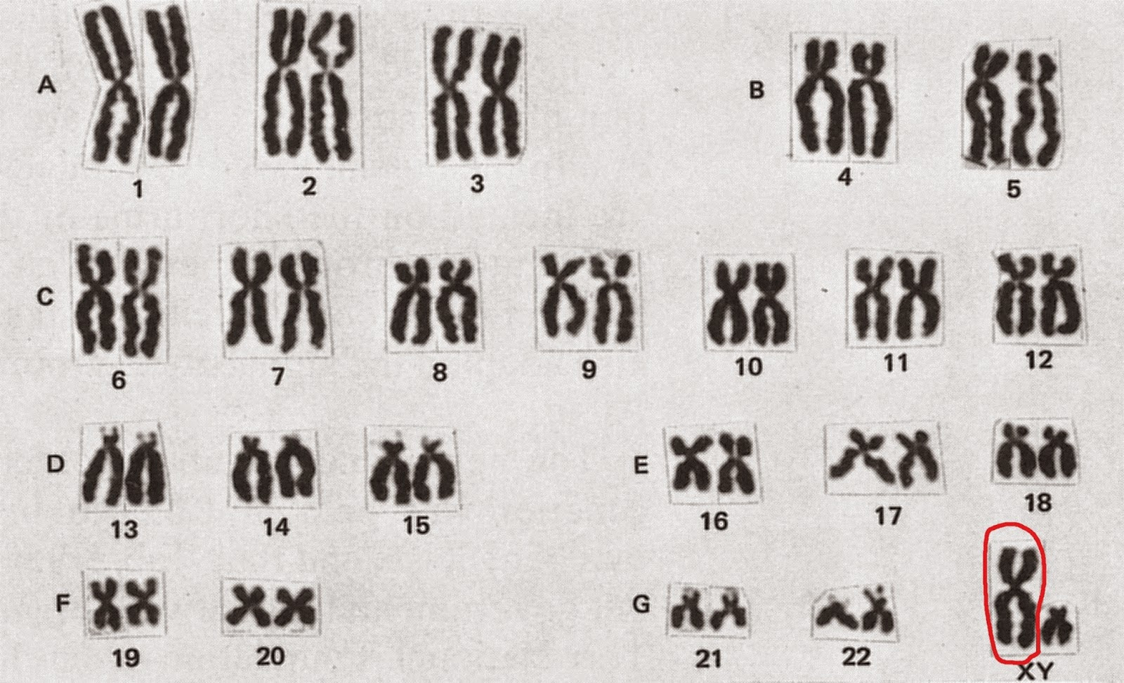 Bombshell Evidence that COVID RNA Base Pairs are Identical to Chromosome 8 Human DNA 0EmViwFQmT