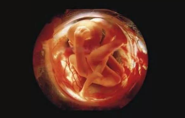 Những bức ảnh đáng kinh ngạc về sự phát triển của thai nhi trong bụng mẹ - 16