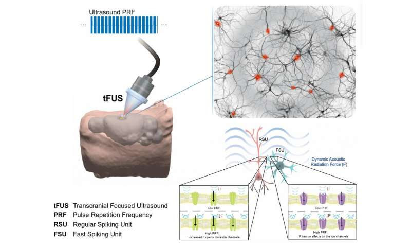 Focused ultrasound enables precise noninvasive therapy