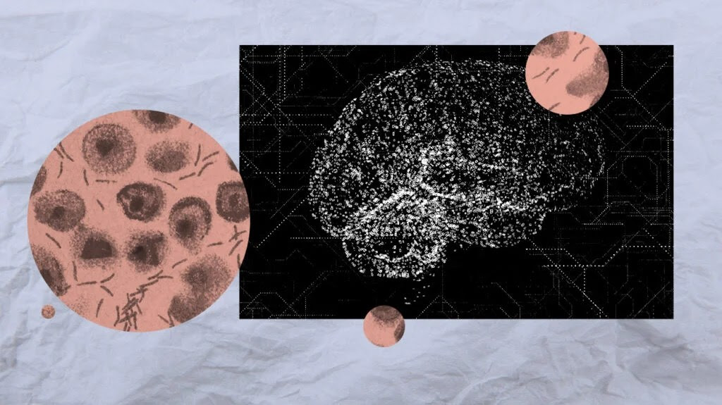 A collage of a scan of the human brain and blood samples to detect Parkinson's