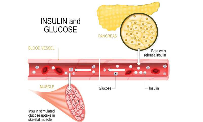 Researchers studying diet composition — with no weight loss — to treat Type 2 diabetes