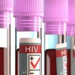 hiv positive blood vials large