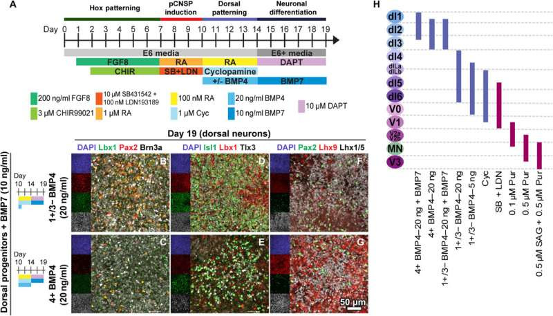 Improved understanding of early spinal cord development paves the way for new treatments