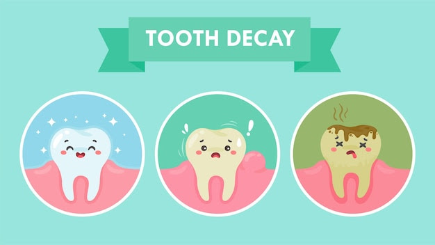 Premium Vector | Cartoon teeth and gums inside the mouth are happy with the  problem of tooth decay. There are plaque on the teeth.