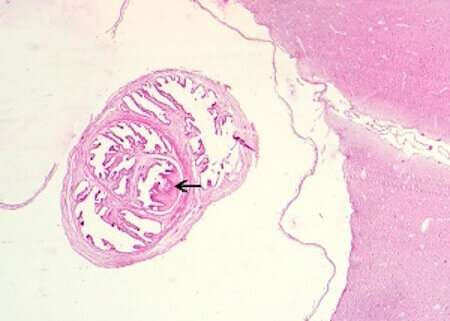 The diagnosis of neurocysticercosis