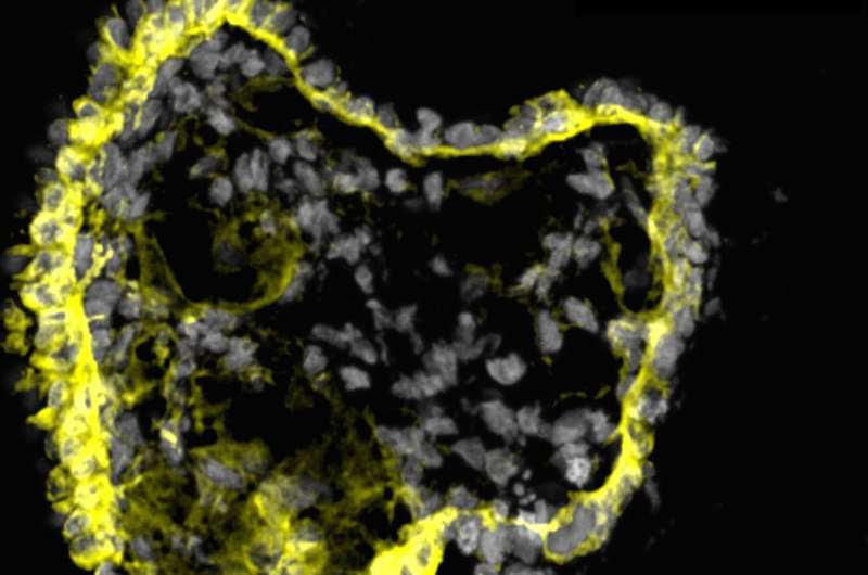 USC Stem Cell scientists use mini-kidney models to identify potential drugs for polycystic kidney disease