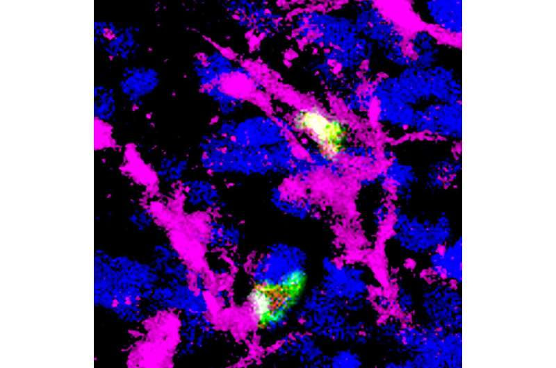 Common tumor inhibitor drug triggers favorable and unfavorable immune effects