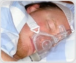 Study highlights significant clinical differences between men and women with sleep apnea