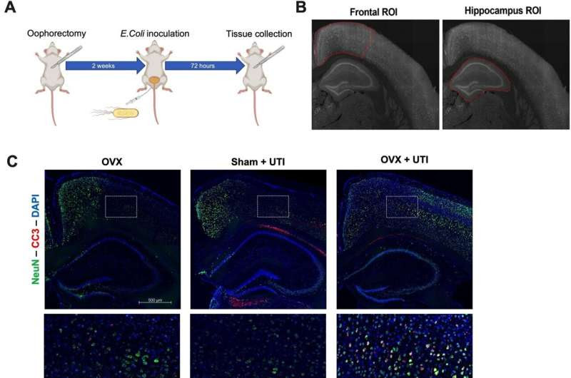 Estrogen may offer protection against delirium