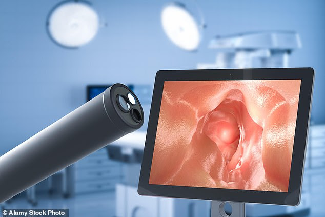 Relief at hand: The portable LumenEye, which is currently being used in six NHS hospitals, may replace sigmoidoscopies