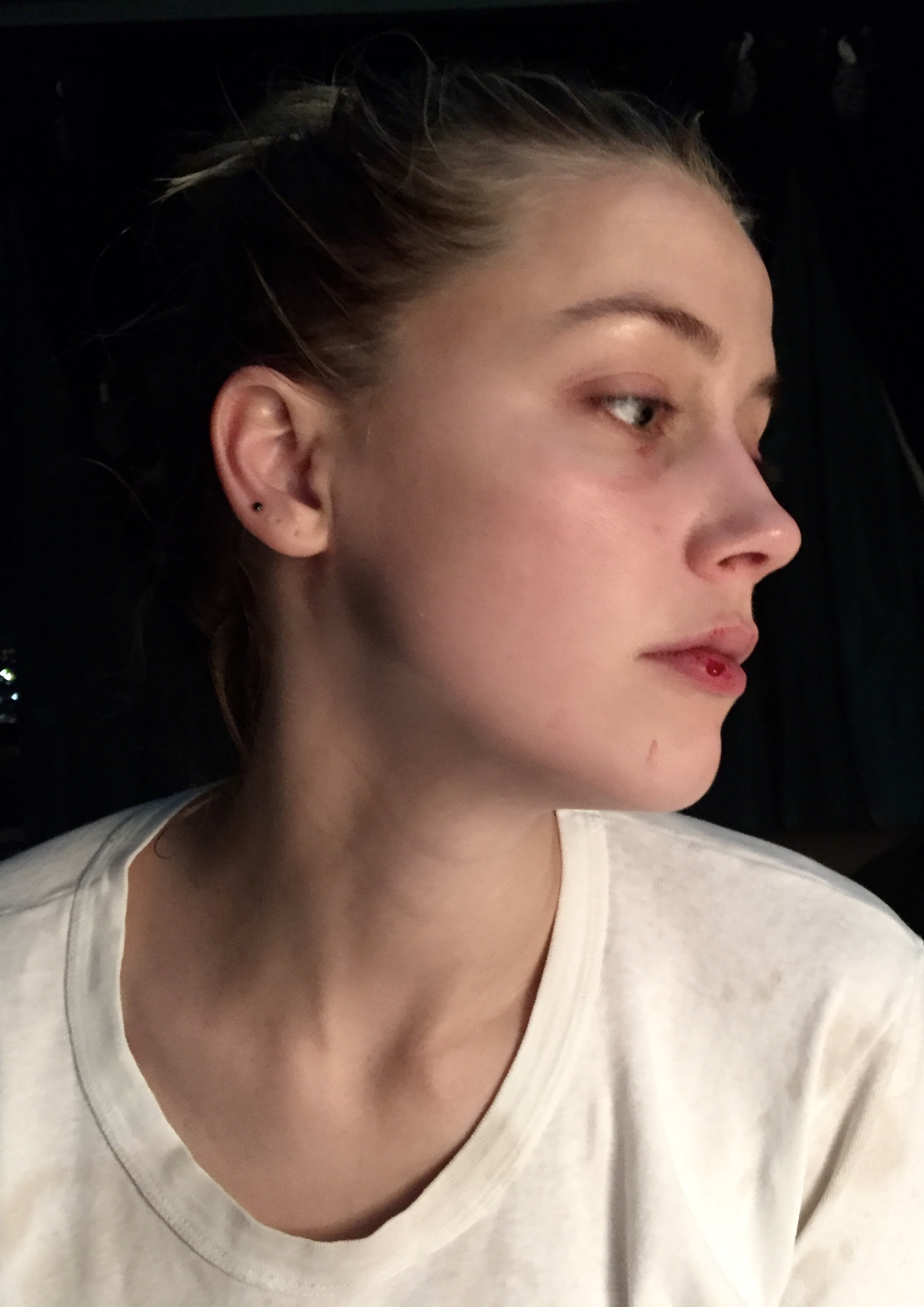 Pictures also showed cuts to the actress's lip