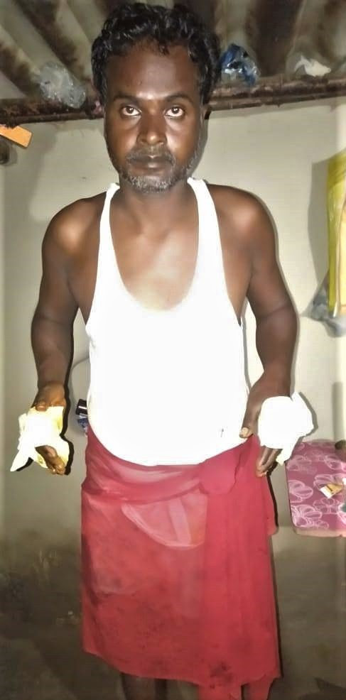  A Christian identified only as Sabajeet said police beat him in Sultanpur District, Uttar Pradesh. (Morning Star News)