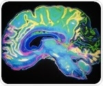 Deep brain stimulation may improve survival for Parkinson's patients