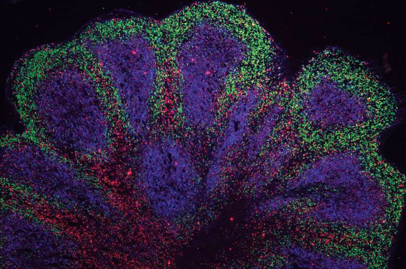 Lab-grown 'mini brains' hint at potential treatment options for motor neurone disease and frontotemporal dementia