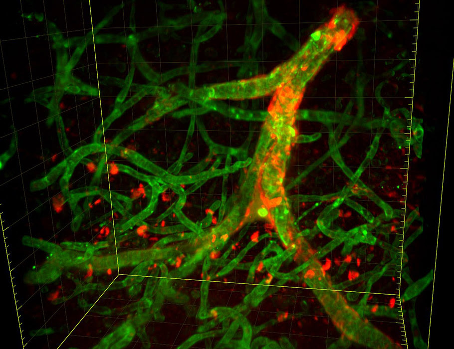 Beta amyloid is stained in red, collagen in green