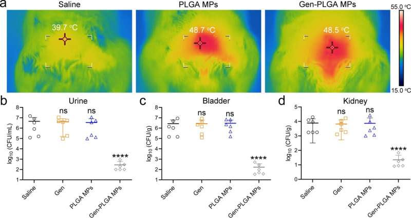 novel in-situ microwave hyperthermia therapy to boost efficacy of conventional antibiotics by overcoming multidrug-resistant Es