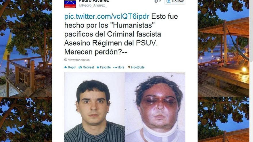 Torturado vasco