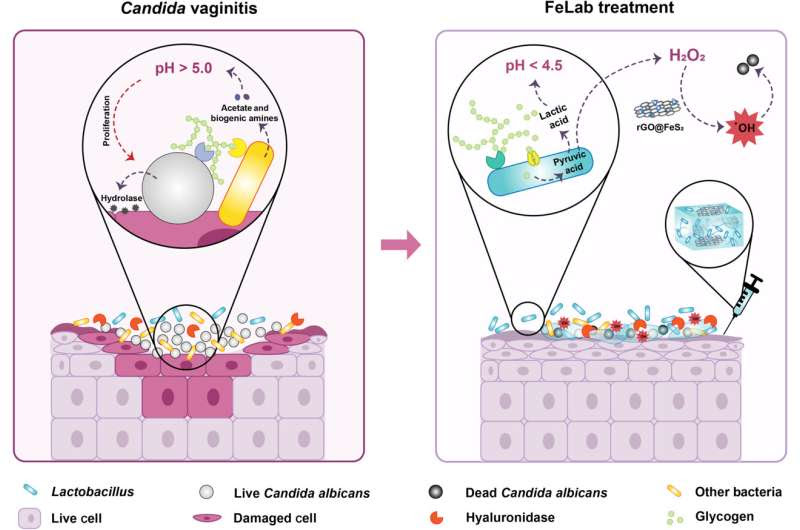 Nanozyme hydrogel: A breakthrough solution for Candida vaginitis treatment