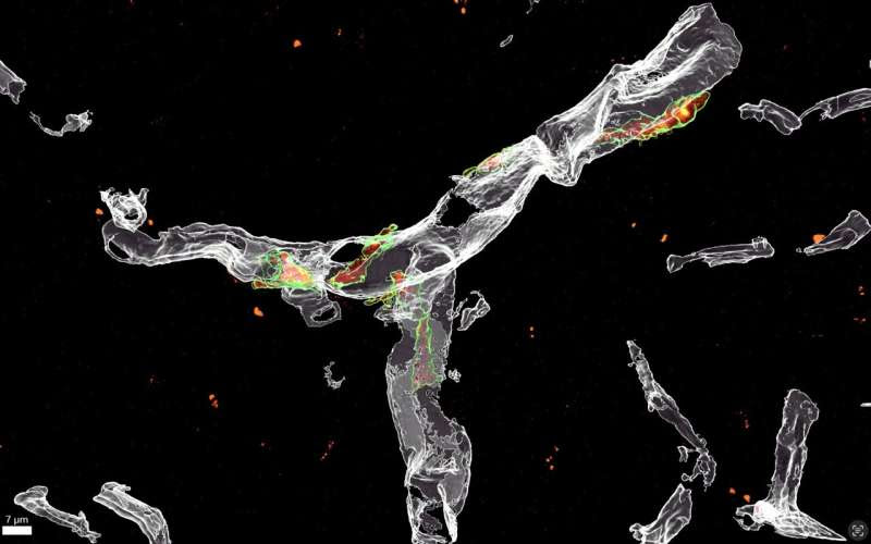 Perivascular cells could induce microglial malfunction associated with Alzheimer's disease