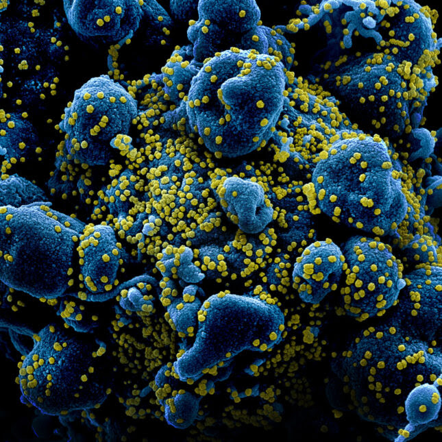 Blue SARS-CoV-2 Colorized scanning electron micrograph