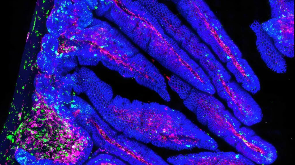 A contrast image of a human intestine with microbial organisms