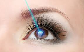 Resultado de imagen para laser medicina ojo