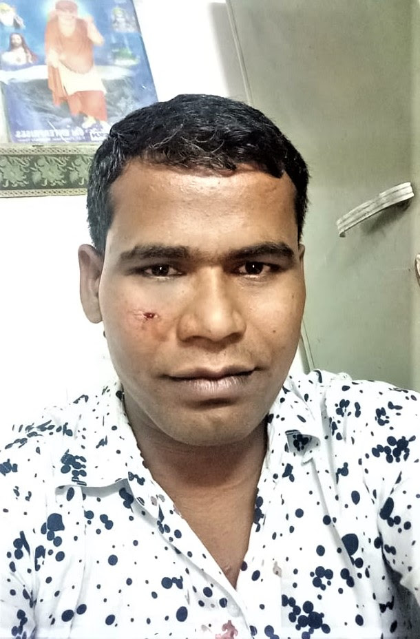  Pastor Ravi Kumar received a blow with a hockey stick below his eye. (Morning Star News)
