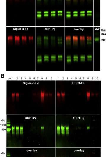 Researchers link sugar-studded protein to Alzheimer’s disease