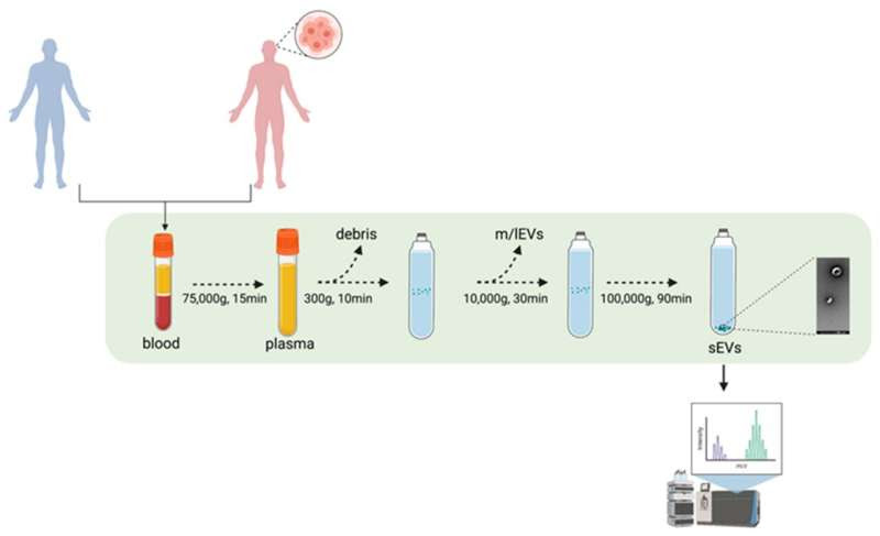 Major step forward in development of diagnostic blood test for glioblastoma