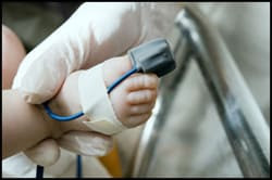 The figure above is a photograph showing a newborn with a pulse-oximeter attached to the big toe.