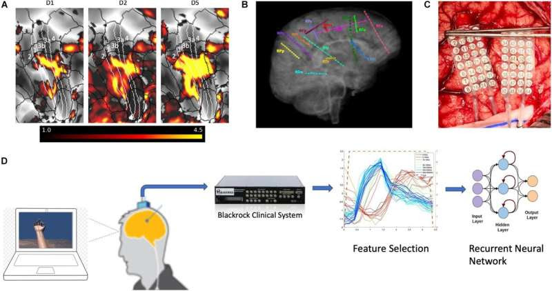 Restoring proprioception and motor control in diabetes, injury and neuropathy patients