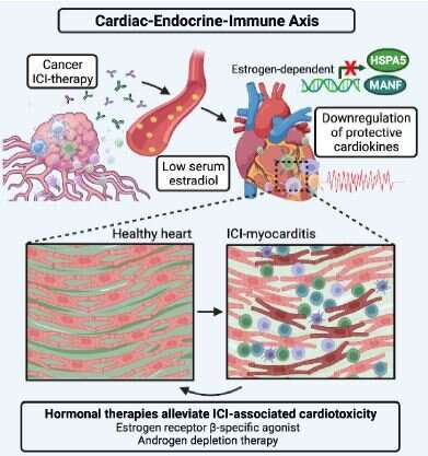 Hormone therapy could lower risk of immunotherapy-associated myocarditis in women