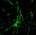 Chen_After-Human astrocyte_10-2015.jpg Astroglial cells after treatment with small-molecule cocktails in the lab of Gong Chen at Penn State University, showing transformation into neurons with long axons and dendrites (credit: Gong Chen lab, Penn State University)