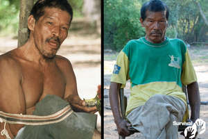 Chiri Etacore cuando estaba sano en el año 2000 (izquierda), y ya enfermo en el año 2011 (derecha). Murió por esta enfermedad similar a la tuberculosis en 2013.