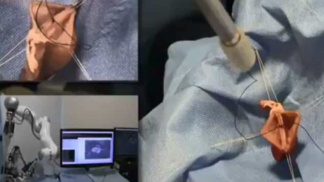 Already, the da Vinci surgical system allows doctors operate remotely by controlling a robot from another room