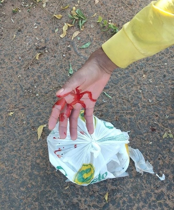 f51fefe4-4dd9-cae9-4a09-8f67e59ed54f “A gente pede consideração”, relata coletor de lixo araguainense que se cortou com vidro