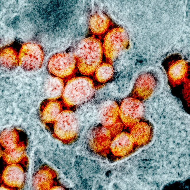 orange electron micrograph