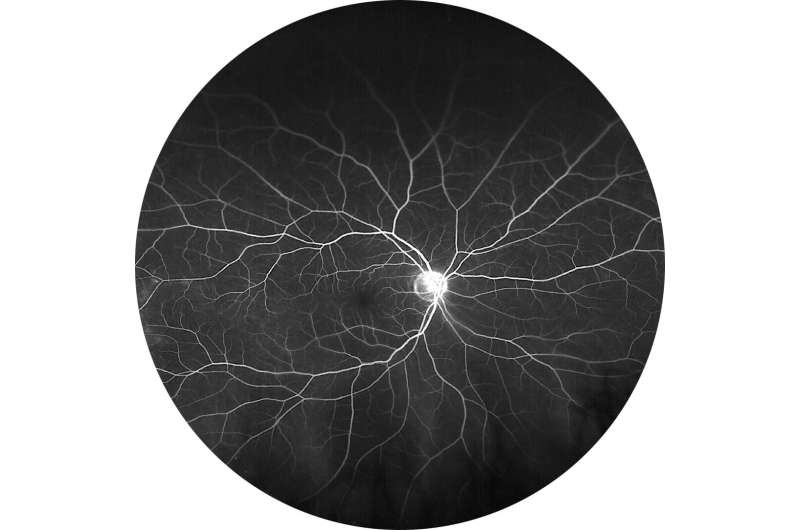 One of two widely used macular degeneration drugs outperforming other at weaning patients off treatment at one year, preliminary