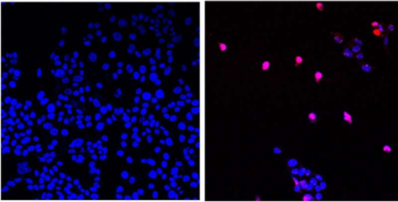 City of Hope scientists develop targeted chemotherapy able to kill all solid tumors in preclinical research