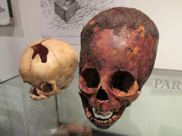 Unwrapping A 2000 Year Old Red Haired Elongated Baby Skull In Paracas Peru  Sddefault