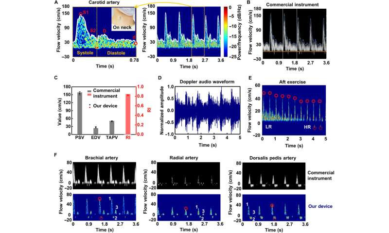 Monitoring blood flow velocity with a flexible Doppler Ultrasound device