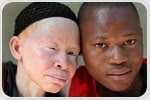 Albinism Diagnosis
