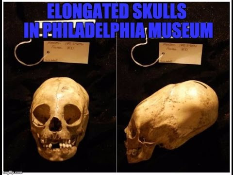 Enormous Peruvian Child's Elongated Skull In The Penn Museum  Hqdefault