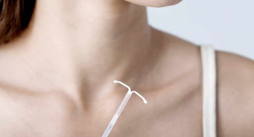 IUD-birth-control