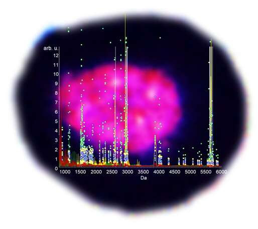 Understanding the differences between healthy and type 2 diabetes-affected pancreatic islets