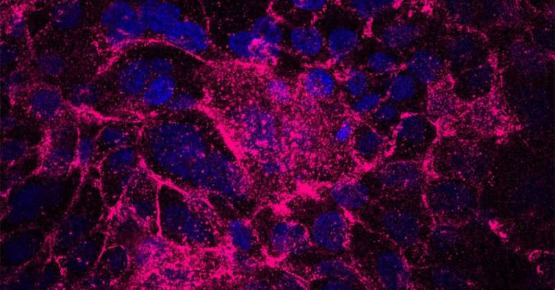 Stress-tolerant cells drive tumor initiation in pancreatic cancer