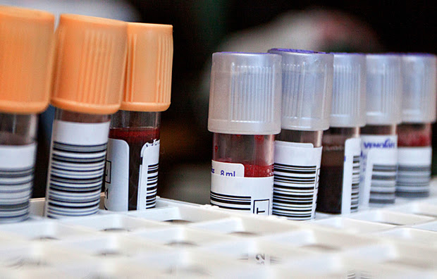 Tubes of blood in a laboratory.