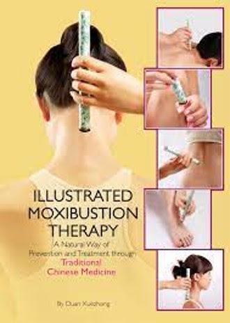 Illustrated Moxibustion Therapy: A Natural Way of Prevention and Treatment through Traditional Chinese Medicine EPUB
