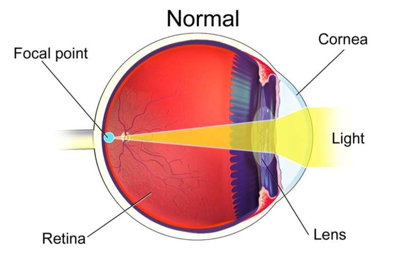 New eye drops can help aging people see better – an optometrist explains how Vuity treats presbyopia