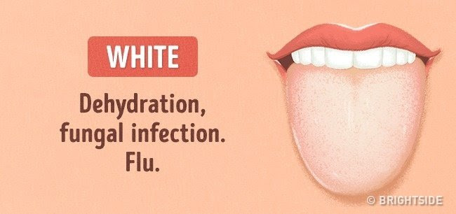 Màu trắng: Mất nước, nhiễm nấm và cúm
